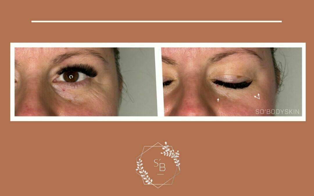 Soin Expert anti-âge - Résultat en 1 séance