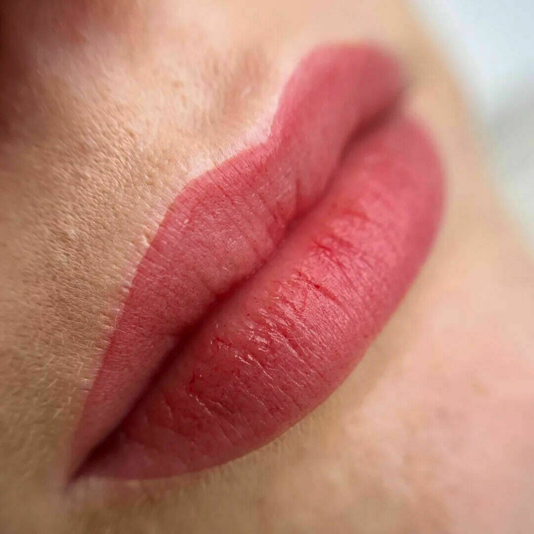 Lippen nach der Behandlung 