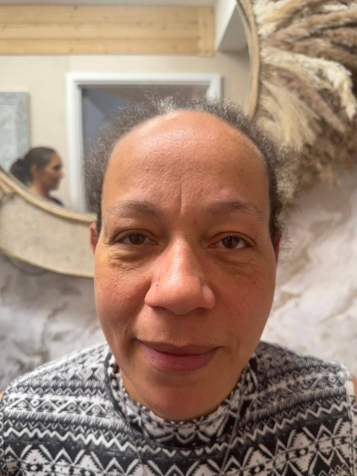 Lumi eyes straight off the needle