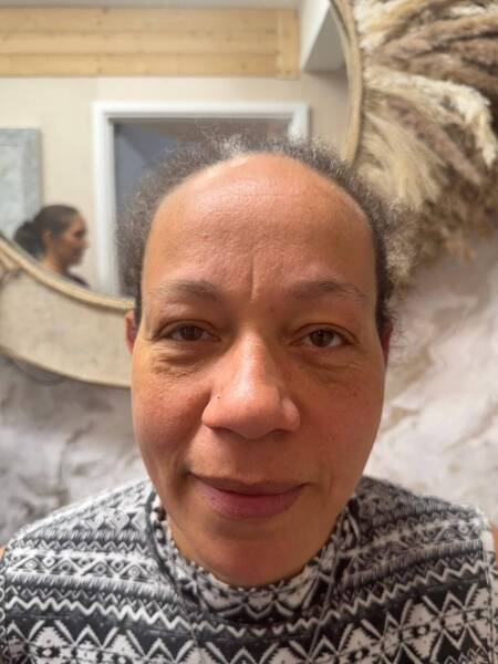 Lumi eyes straight off the needle