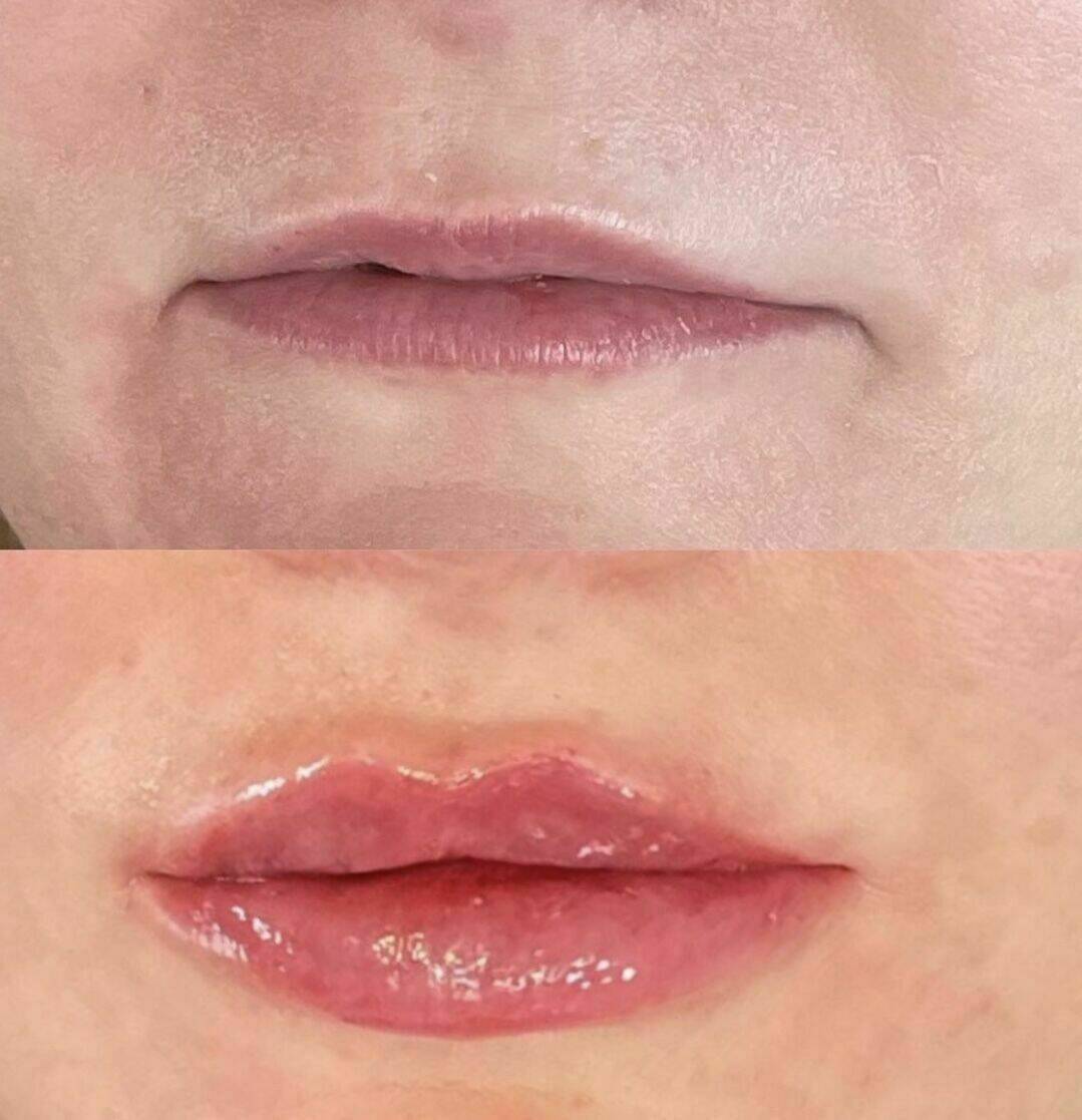 Louise/bbskin clinic/blush brow studio