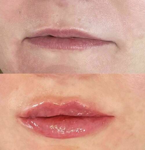 Louise/bbskin clinic/blush brow studio