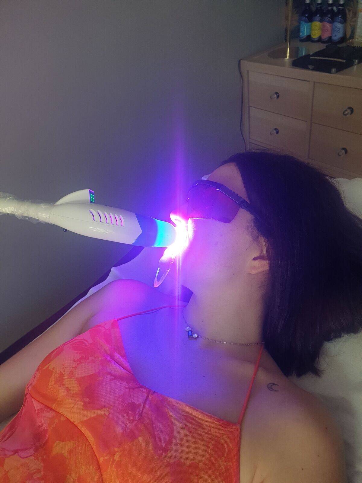 Blanchiment dentaire 