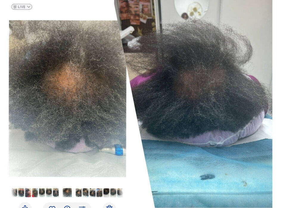 Cure Boost, capillaire femme 10 séances