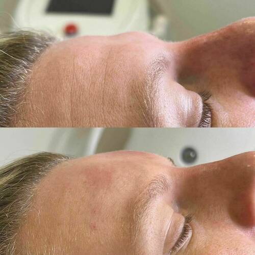 Advanced treatments designed to rebalance your features.