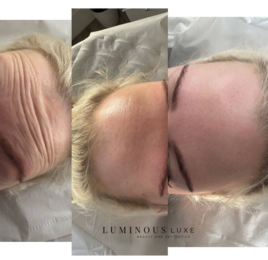 Anti-Wrinkle Goals: FROZEN & FLAWLESS 💅🏽