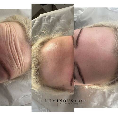 Anti-Wrinkle Goals: FROZEN & FLAWLESS 💅🏽