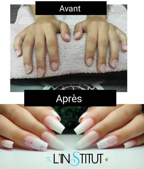 Avant / Après pose capsules Américaine 