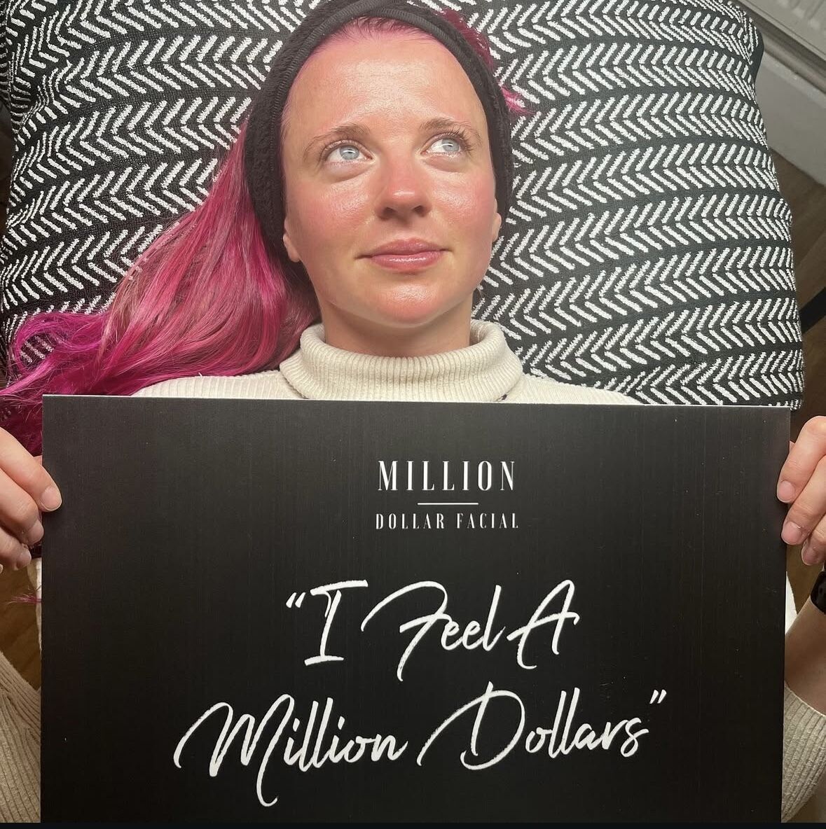 The Ultimate Million Dollar Facial Glow - Includes Microneedling & Dermaplaning