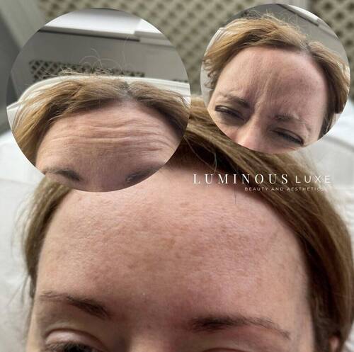 Anti-wrinkle ＭＡＧＩＣ 🪄  