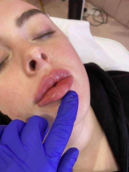 Rᴜssɪᴀɴ ᴏᴠᴇʀʟᴀʏ