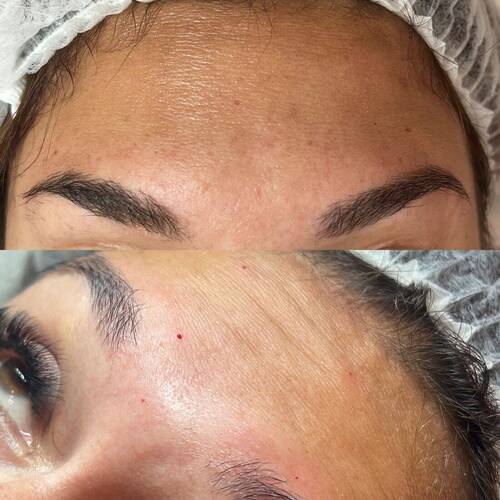 Bottom (Before) & Top (After)