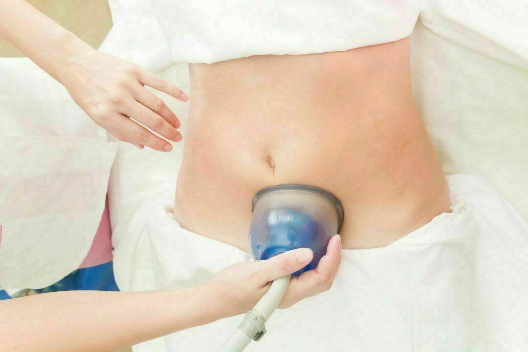 Vacuum Therapy