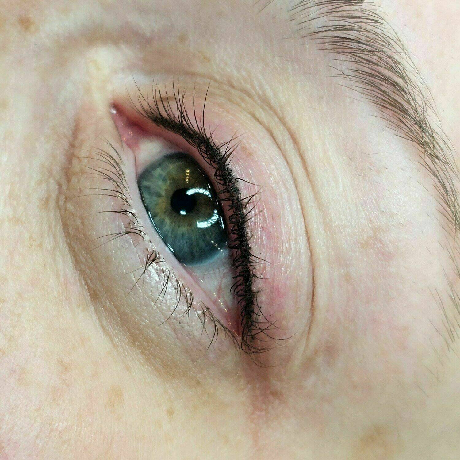 Wimpernkranzverdichtung 