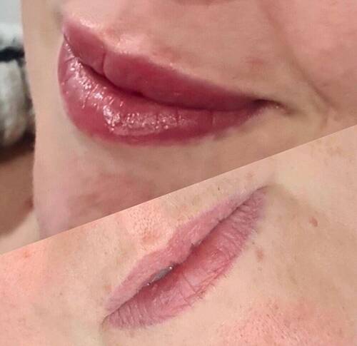 Lip Blush Before & After 