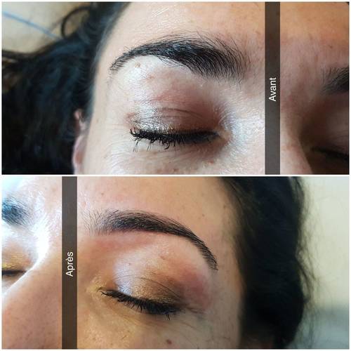 Reconstruction sourcils 