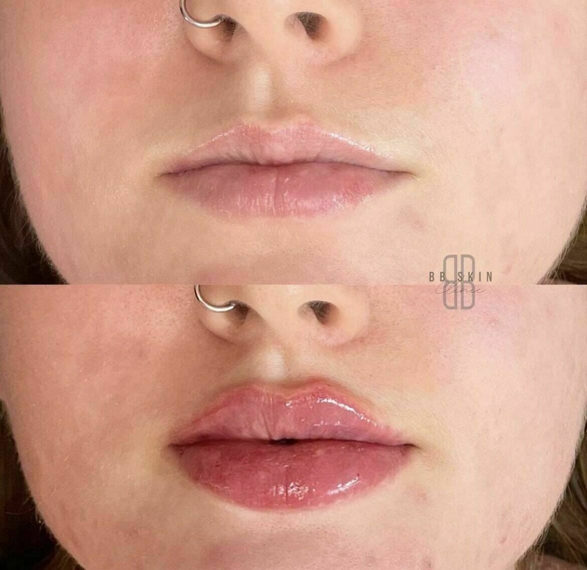 Louise/bbskin clinic/blush brow studio