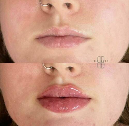 Louise/bbskin clinic/blush brow studio