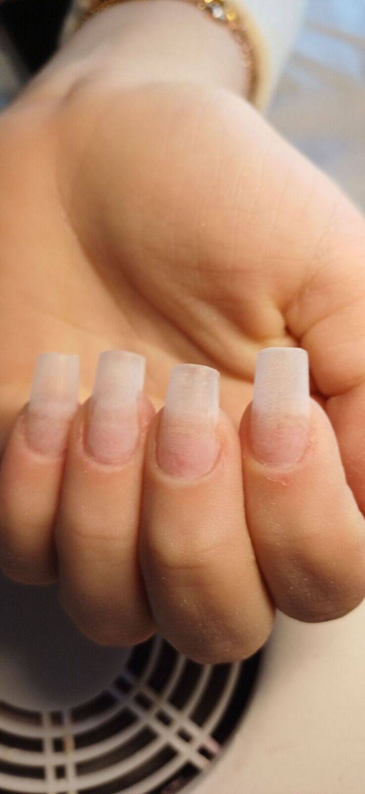 Pose capsule américaine 