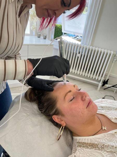 Microneedling Training Day 