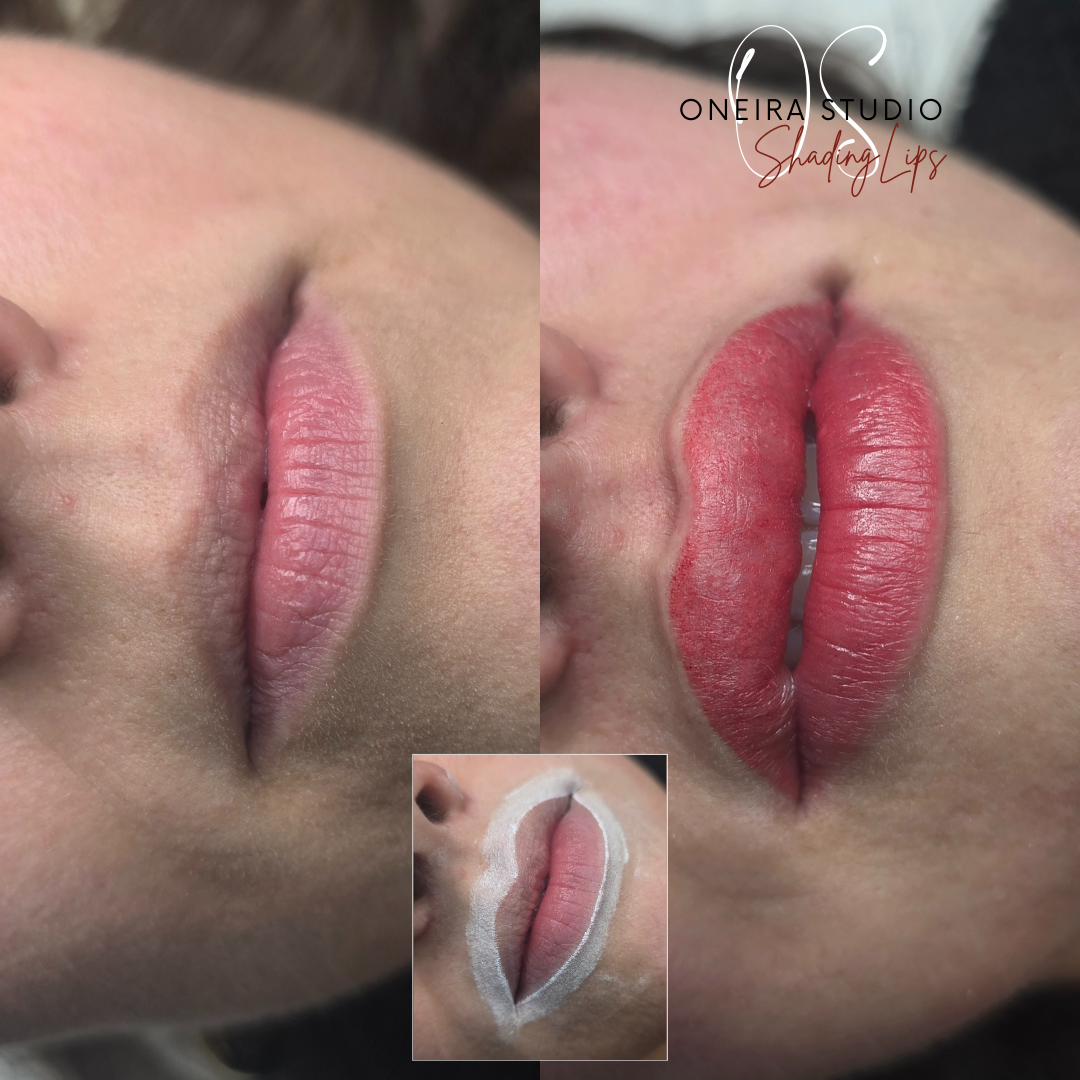 Note : Le gonflement des lèvres est une reaction normale et de nature transitoire. Les lèvres retrouvent leur volume initiale après 2-3 heures.