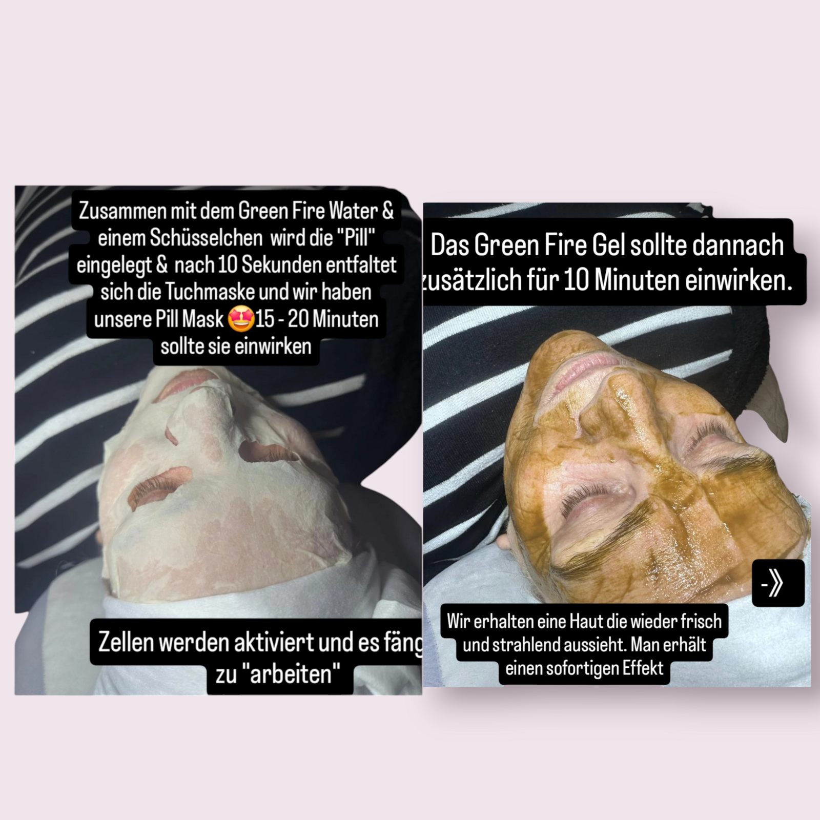 Das Green Fire Water enthält wertvollen Grüntee-Extrakt 🍃, der für seine pflanzlichen, antioxidativen Eigenschaften bekannt ist. Es beruhigt die Haut und unterstützt die Regeneration