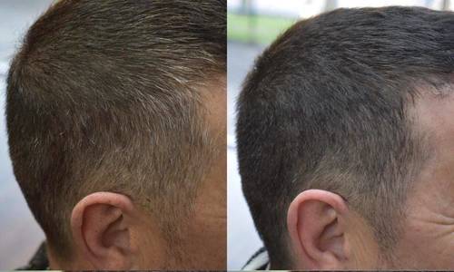 We offer precision blend hair colouring, skin test needed 48hours before