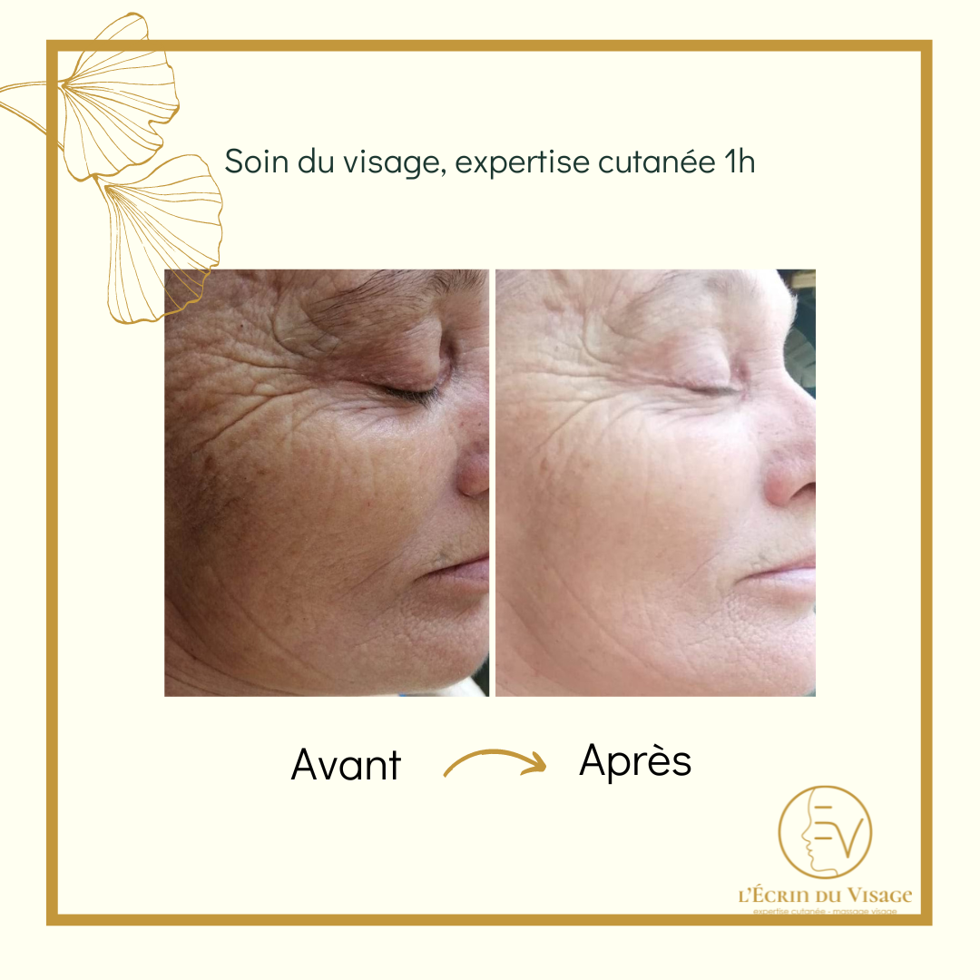 Les résultats Avant Après