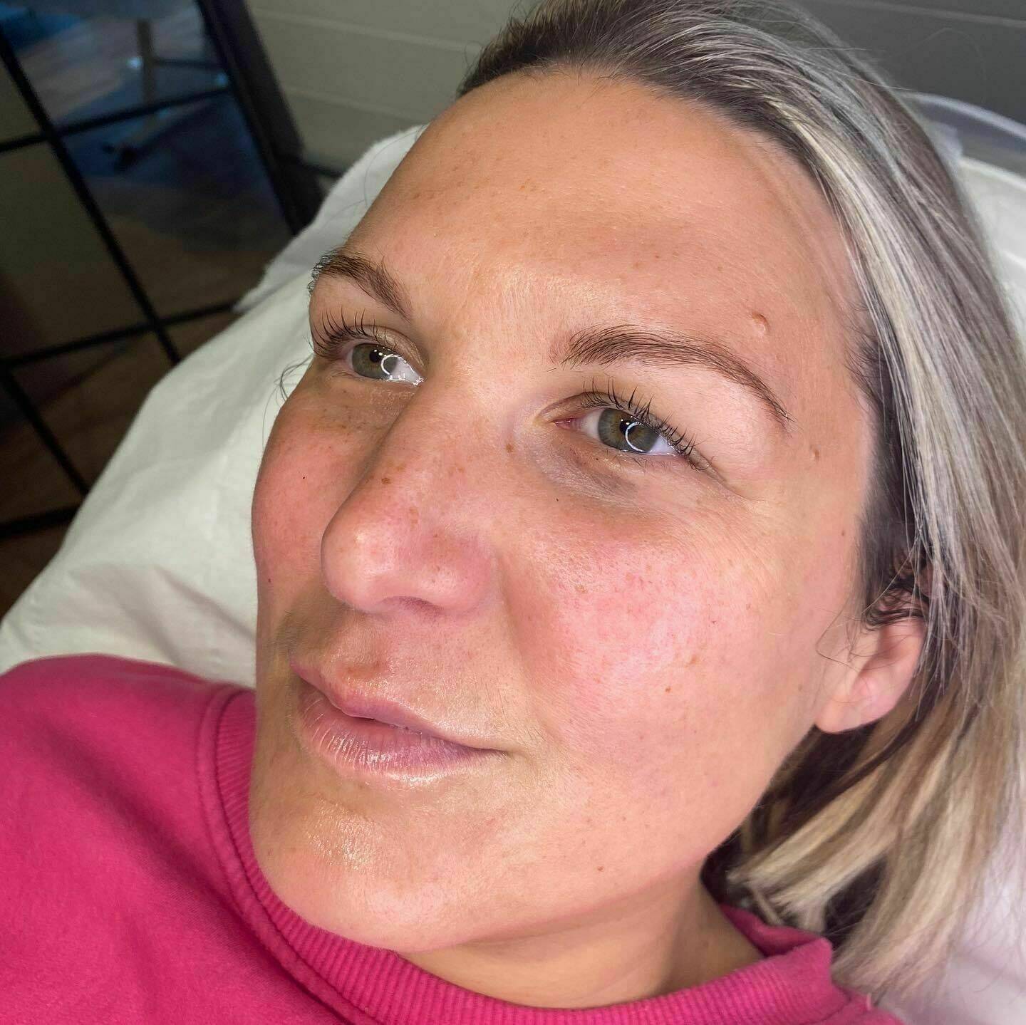 Carboxtherapy Oxygen Facial combined with Lash Lift and Tint.  