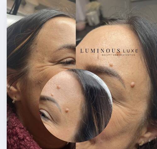 Bye- bye crow’s feet, hello smoother skin! 😍