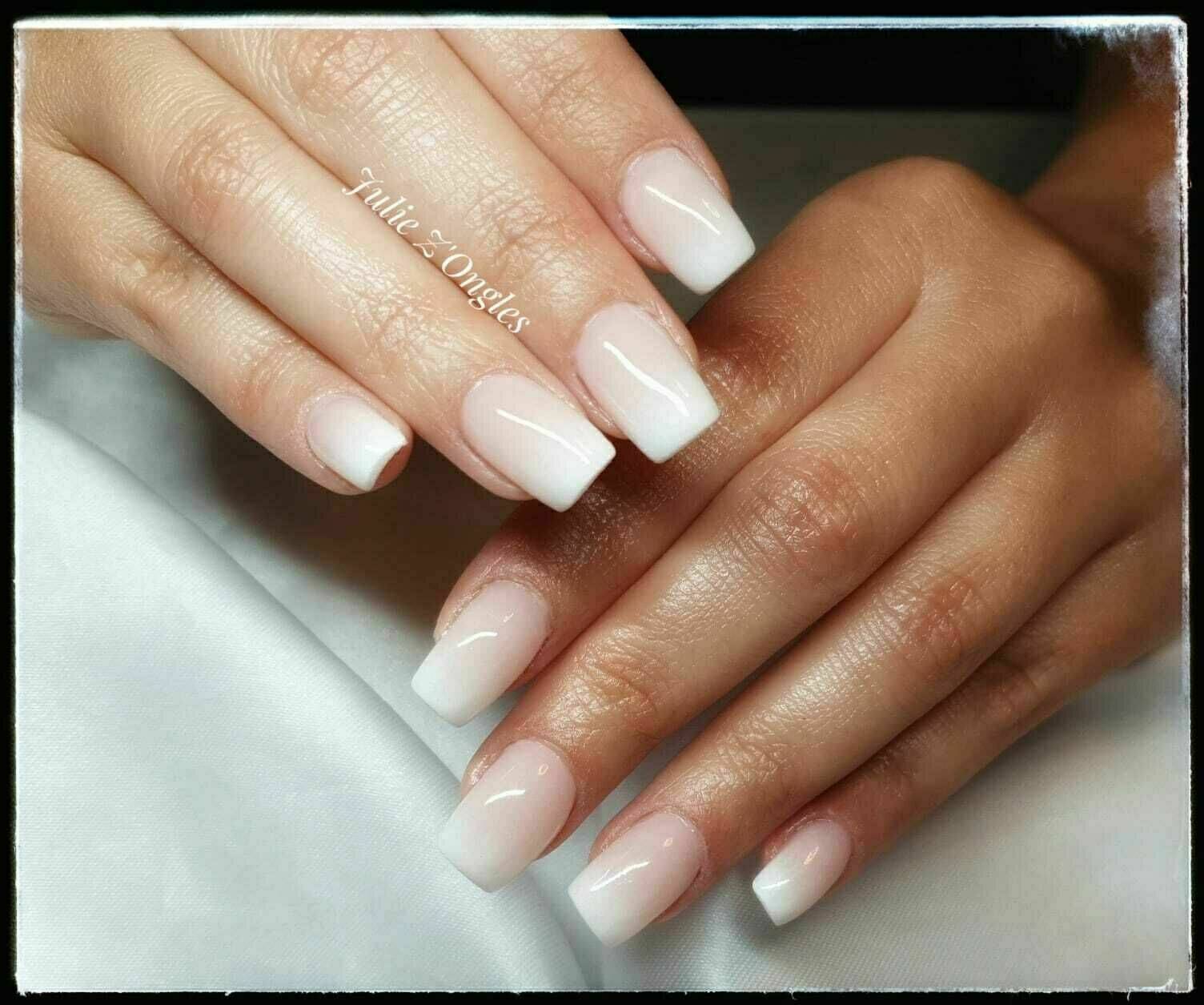 Remplissage Gel et Baby boomer 