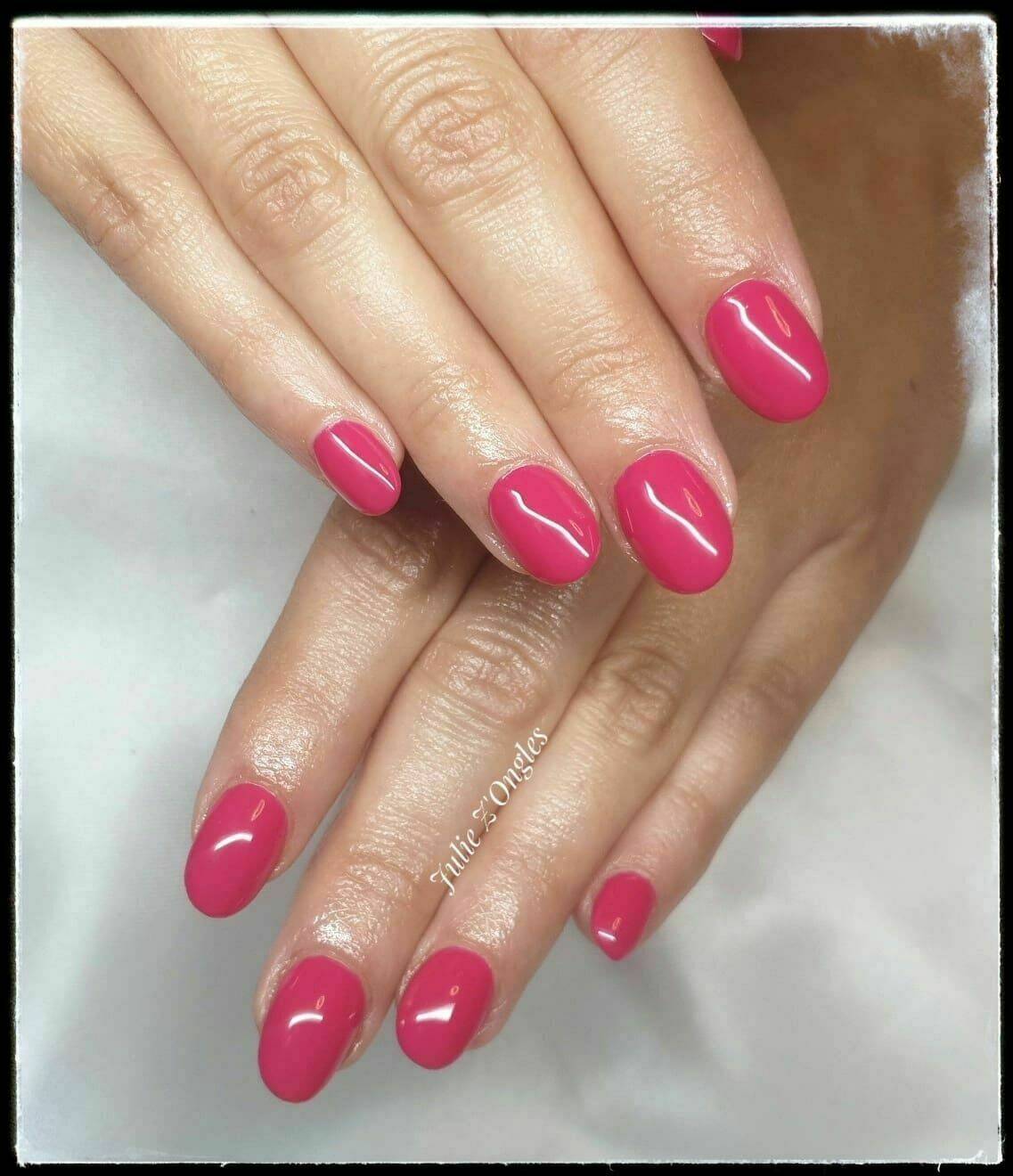 Remplissage Gel 