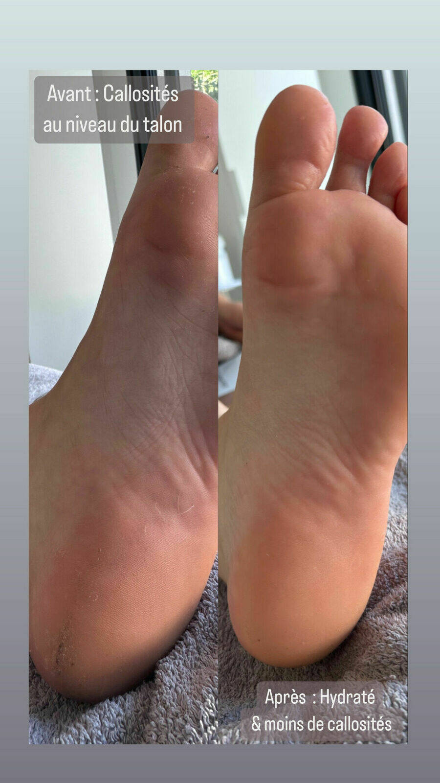 Résultats du traitement 