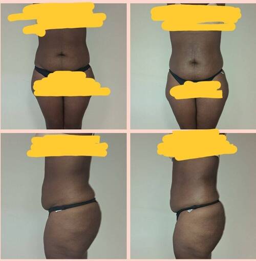 Avant/ Après MINCEUR