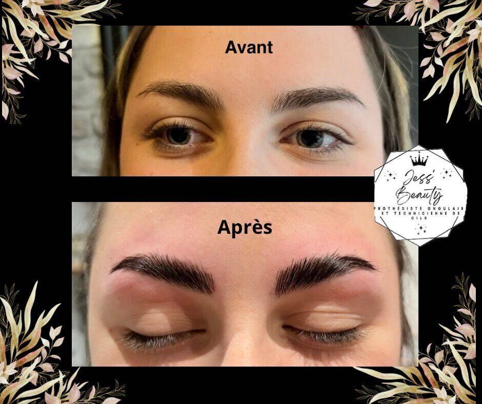  Browlift avec coloration 